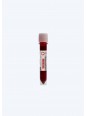 LIGNE DE SANG DE TRANSFUSION EBA EBAAccueil
